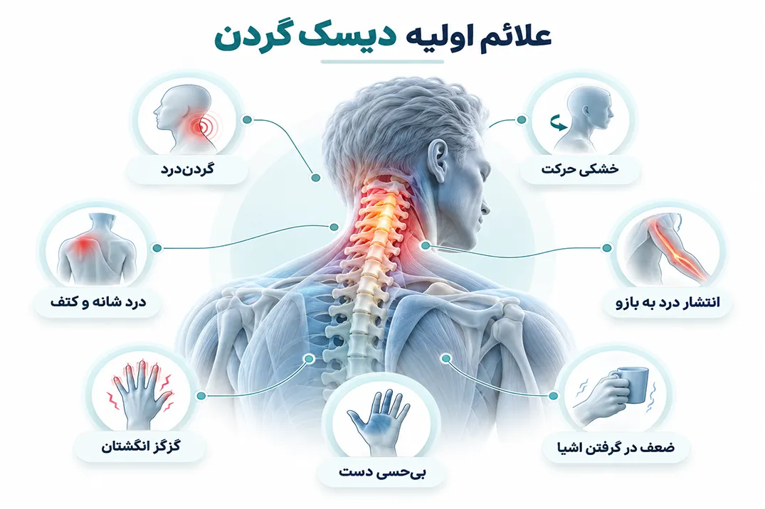 شایع‌ترین علائم دیسک گردن